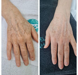 Estética Corporal