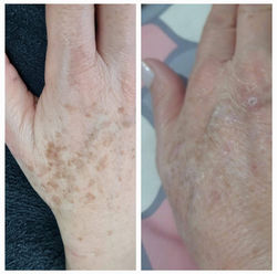 Estética Corporal