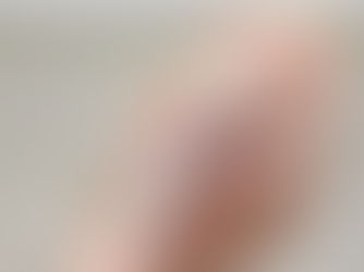 Nova vacina contra a dengue é aprovada pela Anvisa; veja como funciona