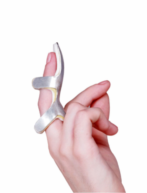 Frog Splint