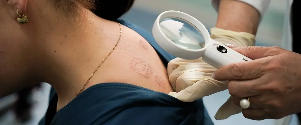 Existe un promedio de solo 2.66 dermatólogos por cada 100,000 personas.