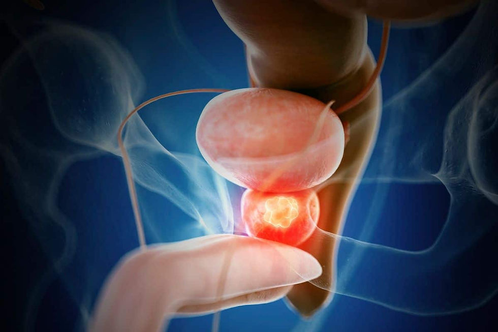 Vencer miedos para combatir el cancer de prostata