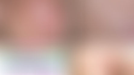 Dark spots and pigmentation removal