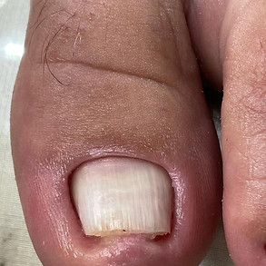 PODÓLOGA IVANE MORAIS | UNHAS ENCRAVADAS | PÉS DIABÉTICOS | OLHO DE PEIXE | MICOSSE | FISSURAS | CALOS E CALOSIDADES | SOROCABA/SP