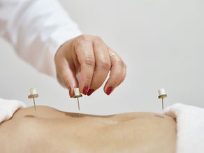 Understanding Moxibustion: A Key Component of TCM