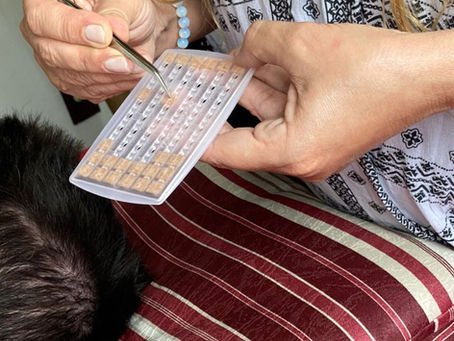 Já ouviu falar da Auriculoterapia?