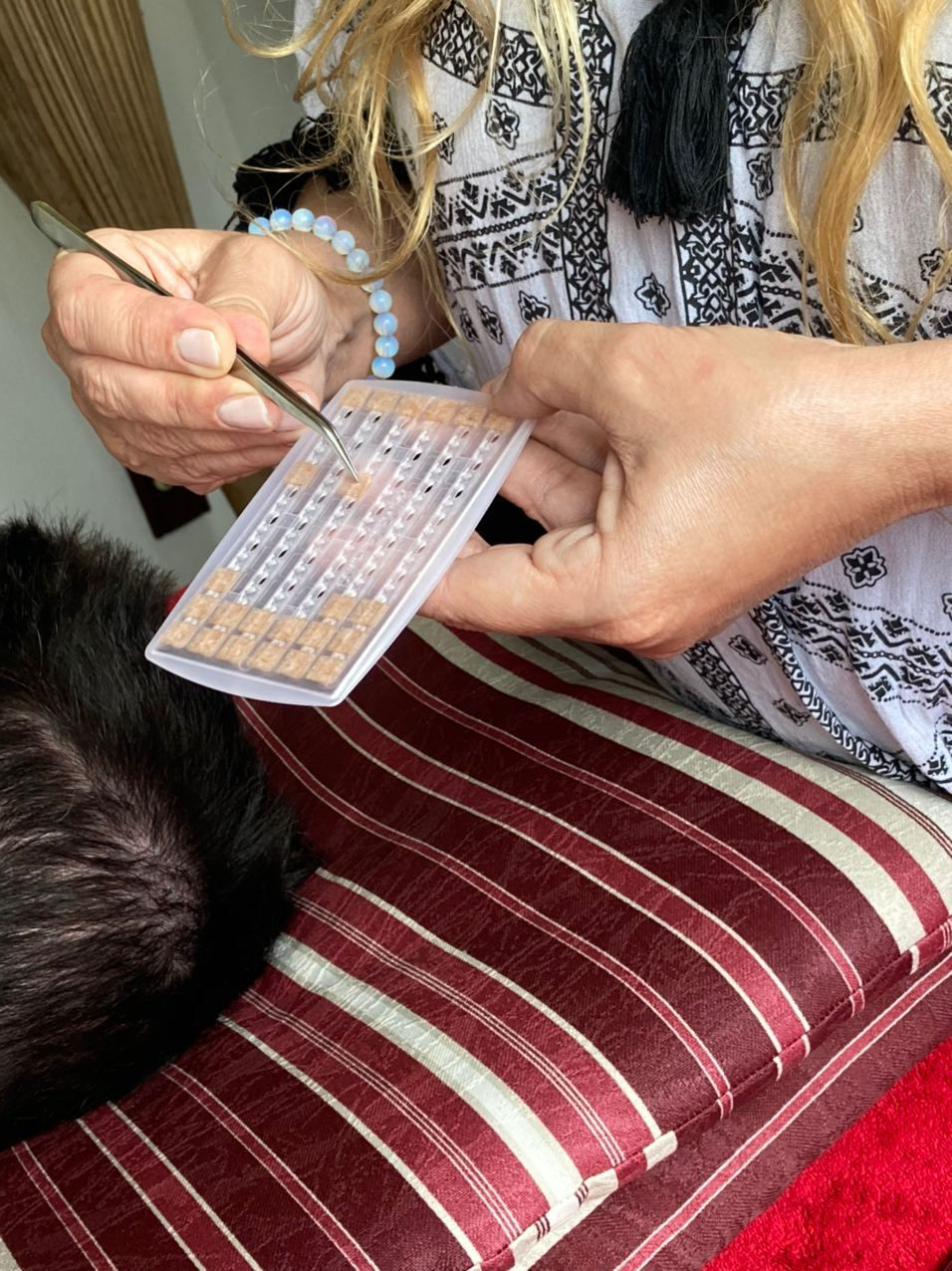 Já ouviu falar da Auriculoterapia?