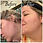Thumbnail: Mud Mask Acne Killer