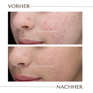 Nahaufnahme einer Hautpartie mit sichtbaren Hautveränderungen und Narben