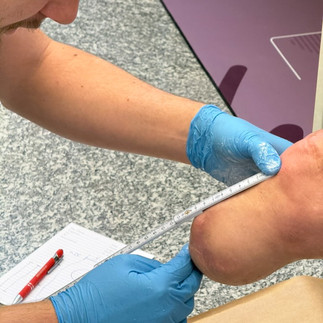 Fasi di preparazione della monolimb