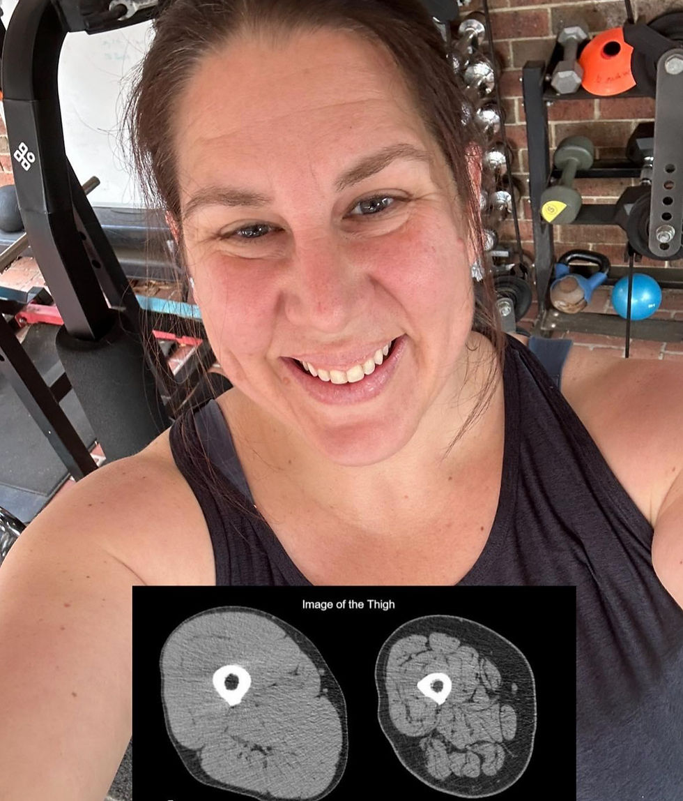 The Weight You Don’t Want to Lose: Why Muscle Matters in Fat Loss (and the Hidden GLP-1 Epidemic)