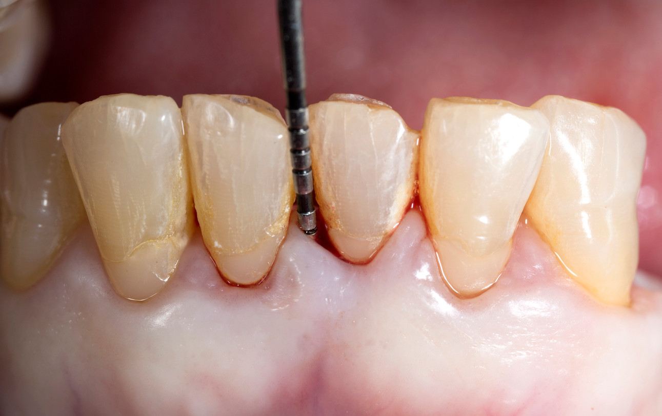 Periodontologia