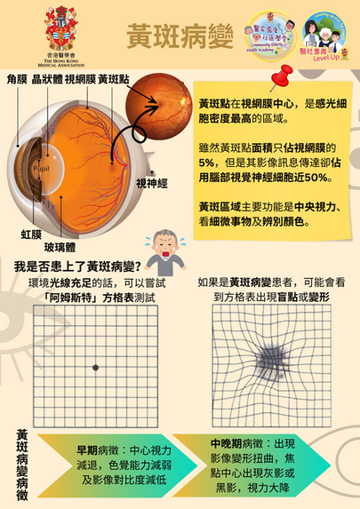 黃斑病變