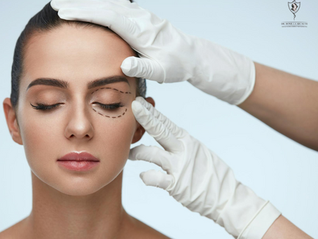 BLEFAROPLASTIA "CIRUGÍA DE PÁRPADOS"