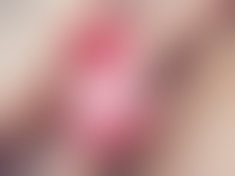 TODO LO QUE DEBES SABER SOBRE LA RECONSTRUCCIÓN MAMARIA