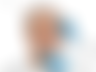 BLEFAROPLASTIA, LA CIRUGÍA DE PÁRPADOS SOLICITADA TANTO POR MUJERES COMO HOMBRES