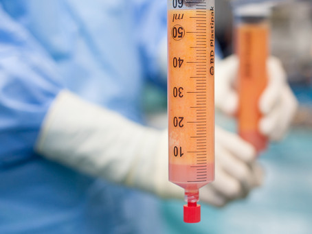 ¿QUÉ ES LA LIPOTRANSFERENCIA?