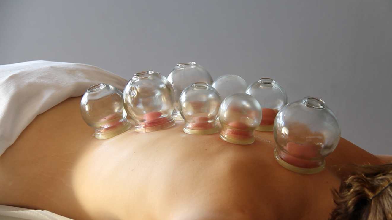 MASAJE DESCONTRACTURANTE CON VENTOSAS