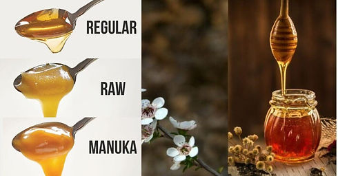 Manuka-honey-1024x536.jpg