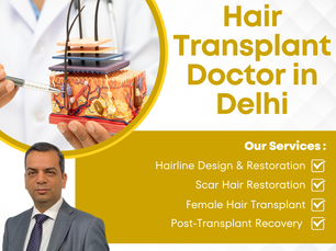 Hair Transplant Surgery in Delhi by Experienced Specialists