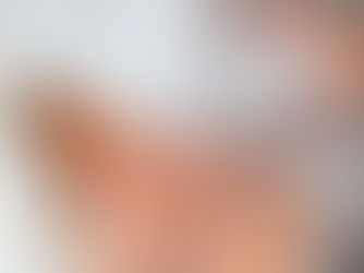How Does Med Esthetiks Support Informed Blepharoplasty Decisions?