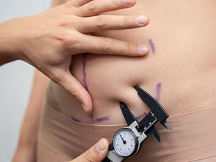Planning Abdominal Contouring Surgery in Delhi | Med Esthetiks