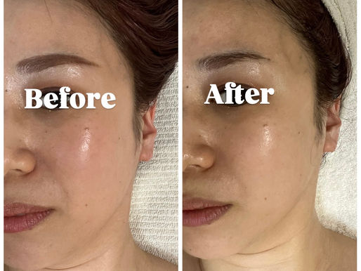 肌は“与える前”に変わり始める。
エキスパートローションで巡りを整えた後のBefore/After