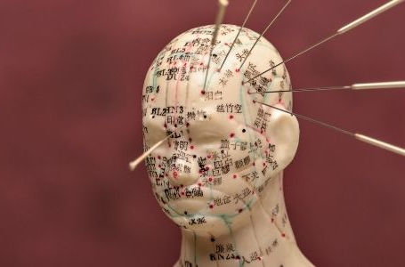 Acupuntura para Enxaqueca: compreender a raiz da dor na Medicina Tradicional Chinesa