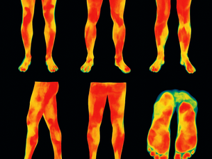 An array of thermal images of legs and feet