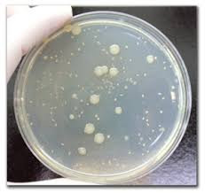 Heterotrophic Plate Count