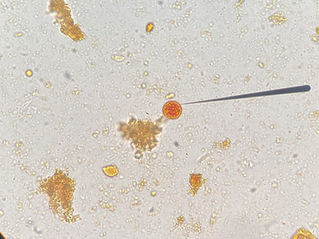 Consejos para una identificación de especies de amebas con interés clínico 