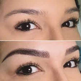 microbleiding.jpg