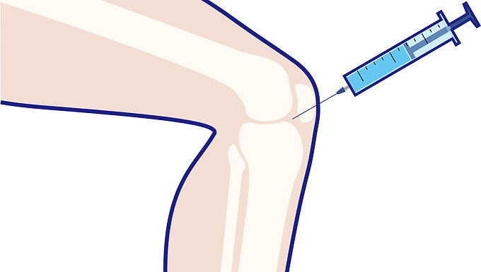 膝関節注射の説明です。