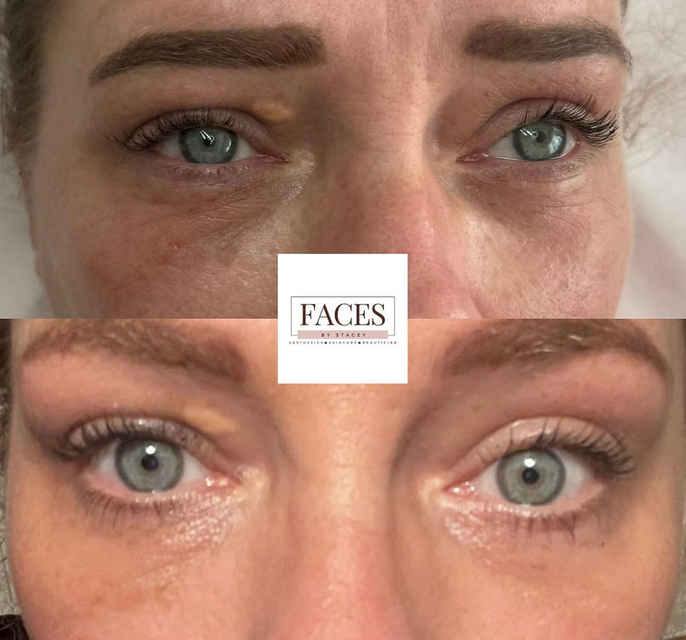 Thumbnail: lumi eyes polynutides