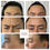 Thumbnail: anti wrinkle 3 areas