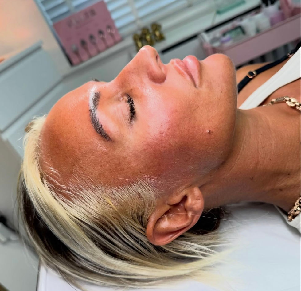 Thumbnail: cheek filler 1.1ml per ml 