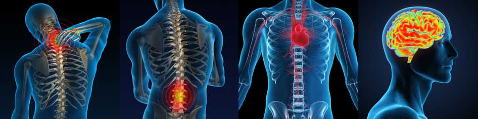Spinal Cord Injury