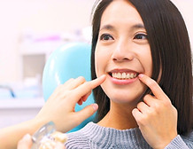 歯を見せる女性