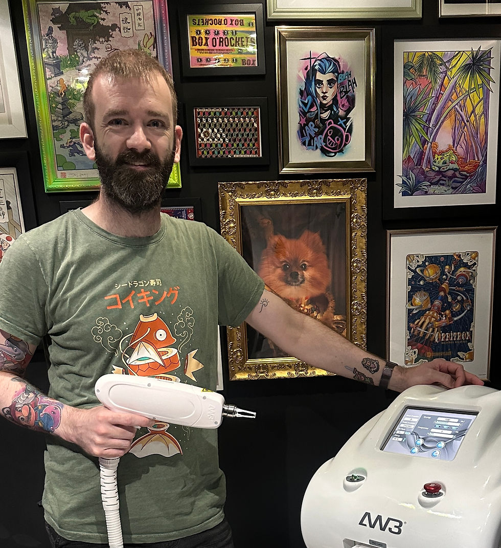 The Emotional Benefits of Tattoo Removal