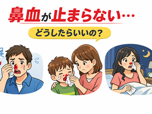 鼻血が止まらない…正しい止め方と受診の目安｜子どもの鼻血も耳鼻科医が解説