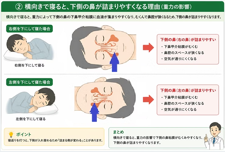 体位による鼻粘膜の変化説明画像