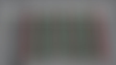 Binocular Accommodative Rock: Level One — Where Focus Meets Teamwork