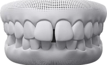 teeth3.png