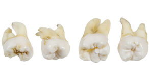 Doctors Urge Parents To Save Their Kid’s Baby Teeth! Here’s Why!