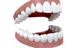 The Different Categories of Teeth