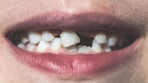 Have You Heard Of Tooth Loss Caused By Diabetes?