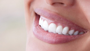 Facts About Tooth Whitening