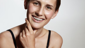 Teeth Straightening: Don't Try this at Home