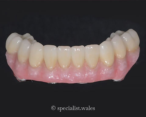 All Of The Lower Teeth