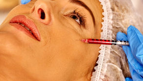 Botox Now Viewed As a Preventive Procedure